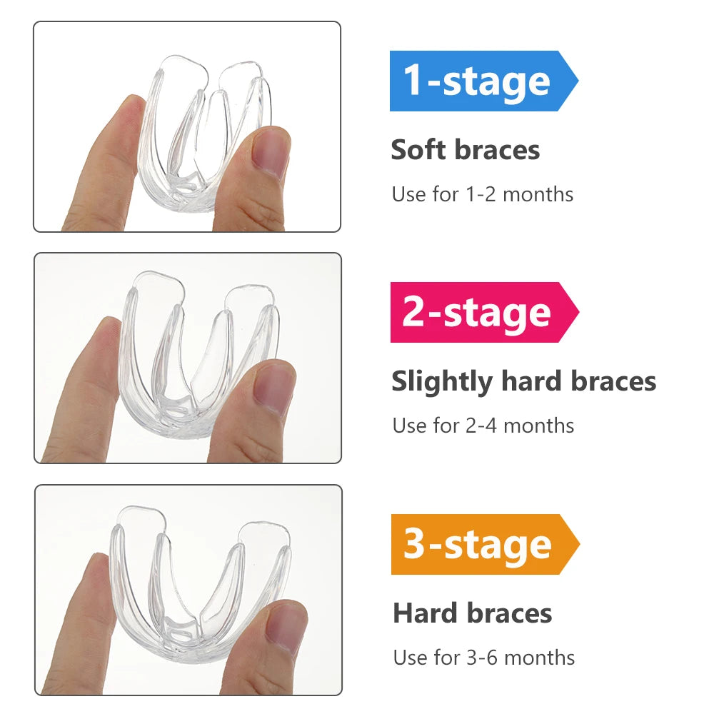 3-Stage Kids Orthodontic Teeth Alignment Trainer Set - 4