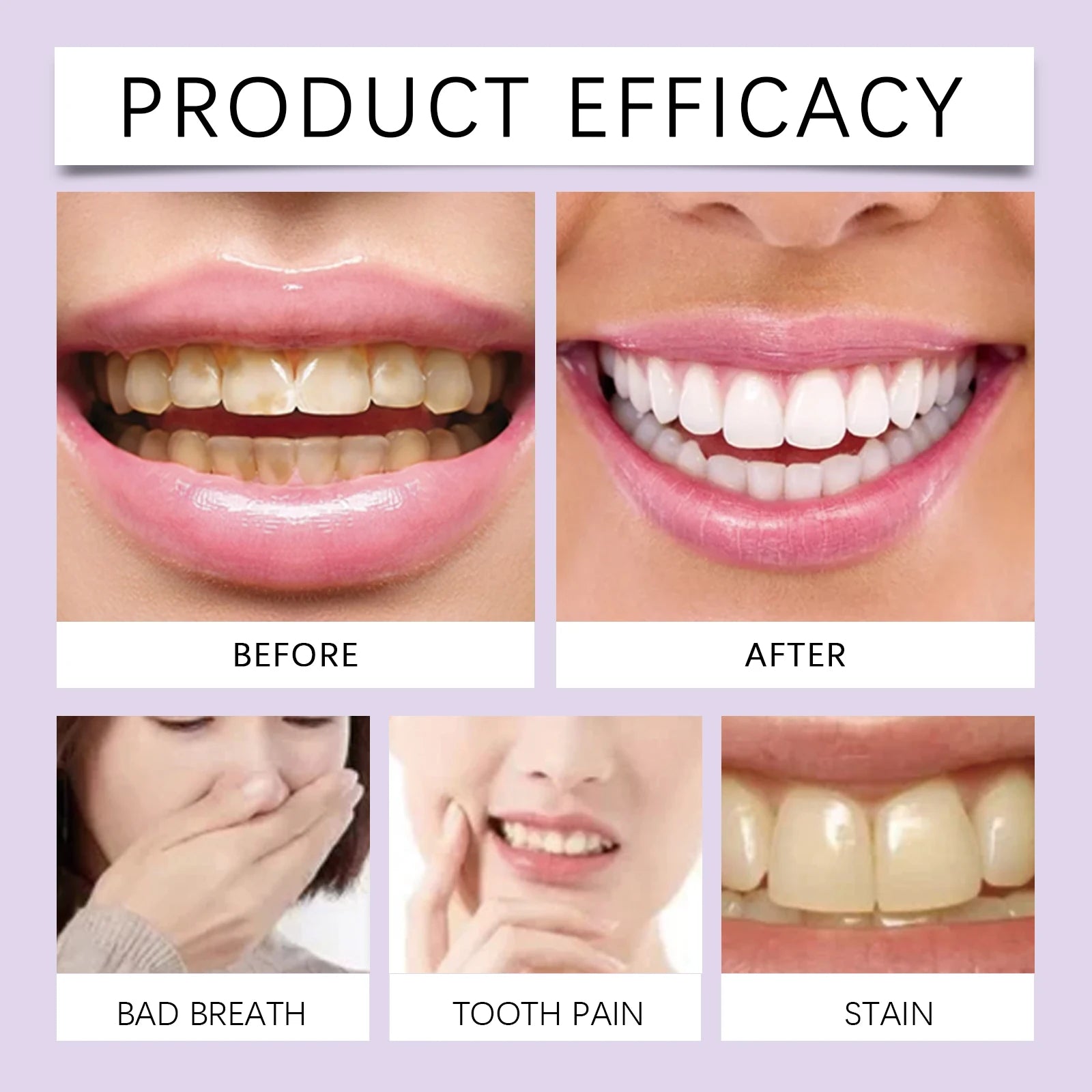 Teeth Whitening and Plaque Removal Cleaning Powder - 4