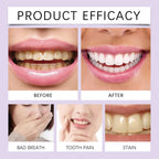 Teeth Whitening and Plaque Removal Cleaning Powder