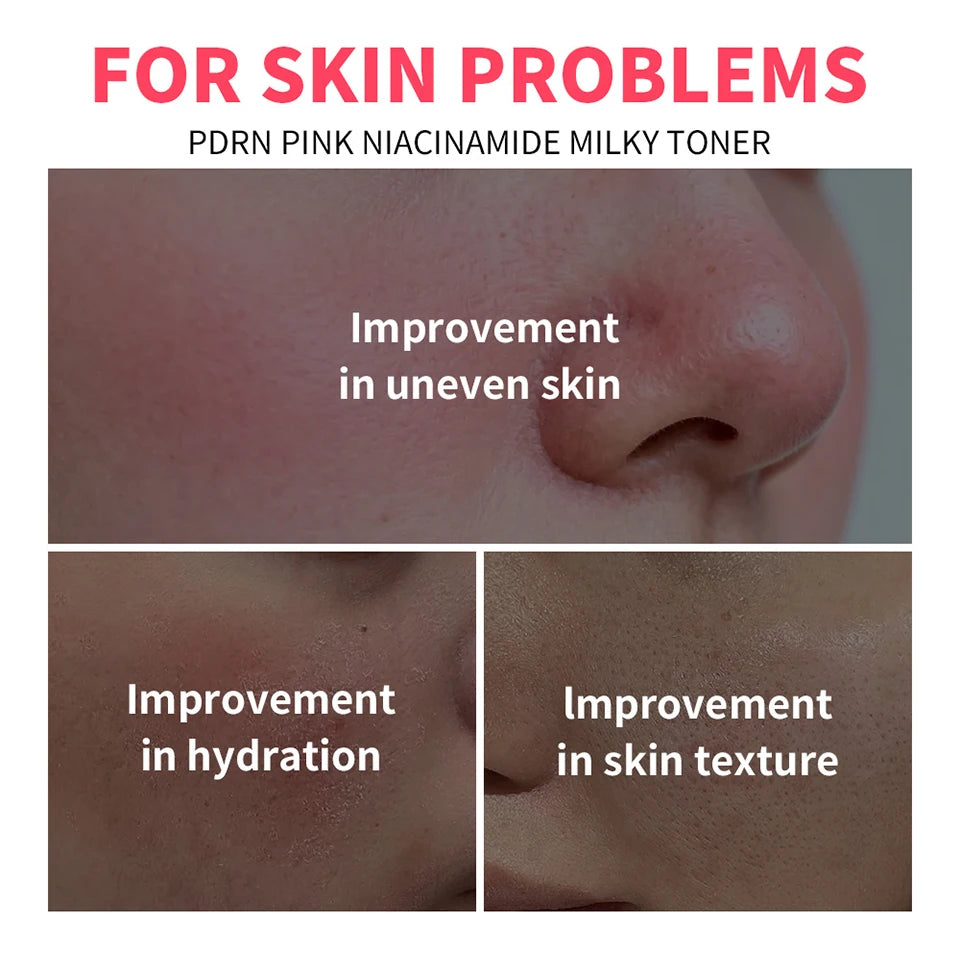 PDRN Niacinamide Milky Toner for Deep Hydration and Glowing Skin