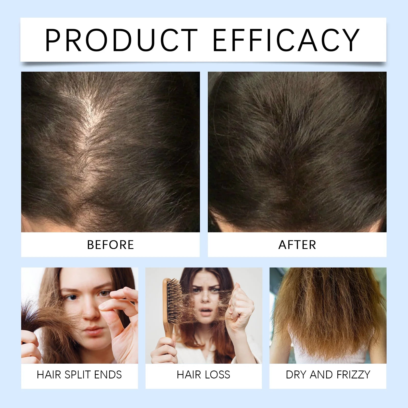 Rosemary Scalp Nourishing Hair Growth Serum Roller - 10