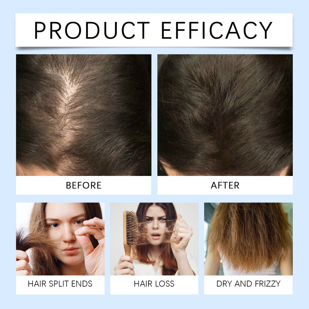 Rosemary Scalp Nourishing Hair Growth Serum Roller