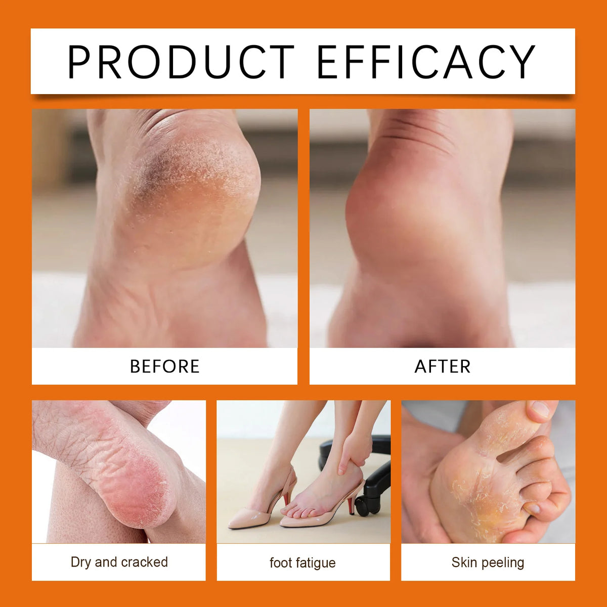 Moisturizing Honey Heel Balm for Dry Cracked Skin Repair
