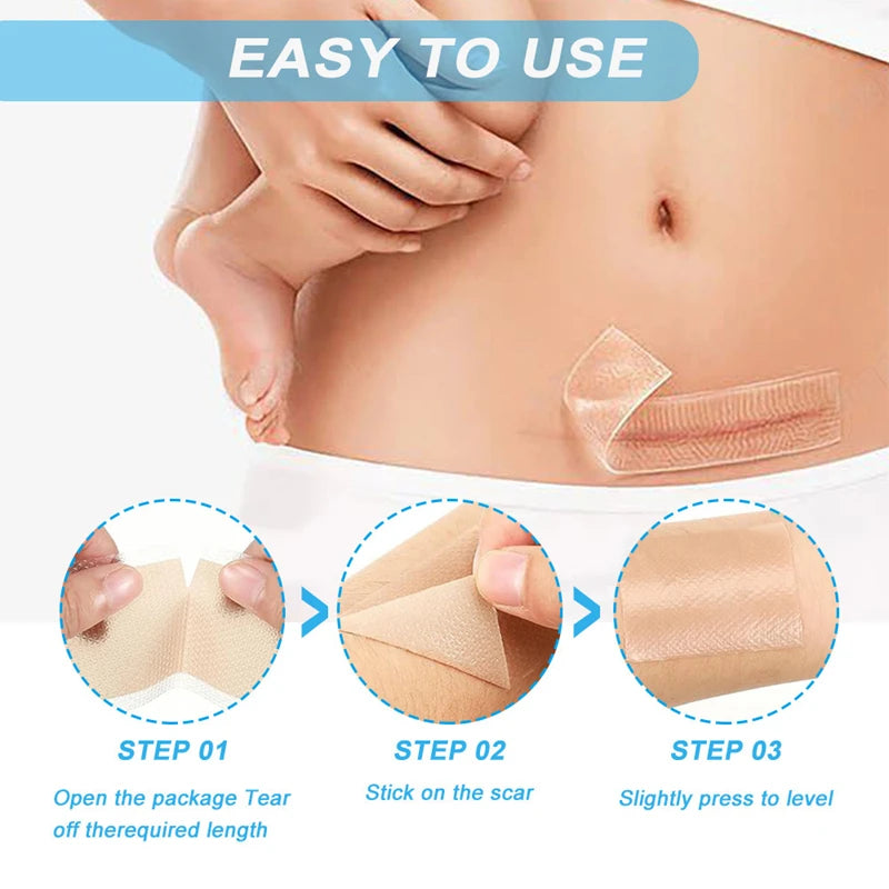 Silicone Scar Removal Tape for Surgery and Burn Scars