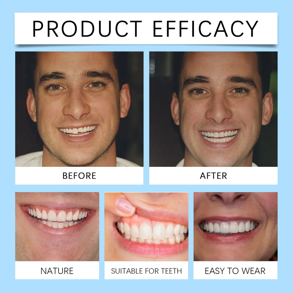 Comfortable Silicone Denture Set for Natural Smile