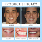 Comfortable Silicone Denture Set for Natural Smile