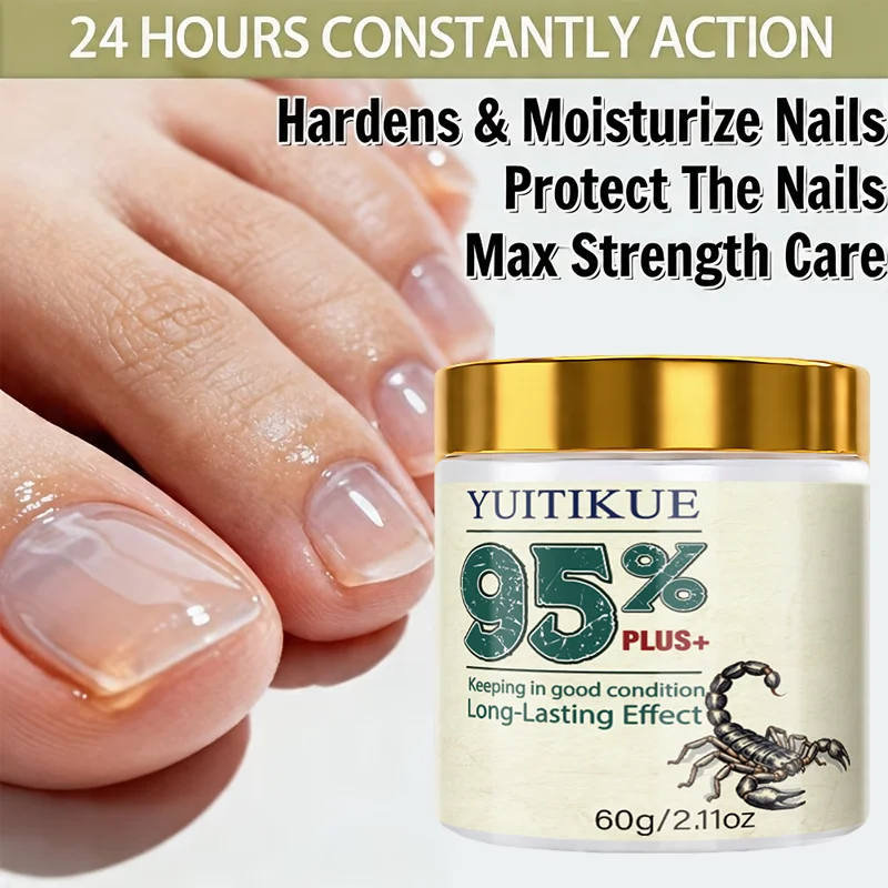 Yuitikue Nail Repair Cream Cuticle Softener and Foot Treatment Balm - 11