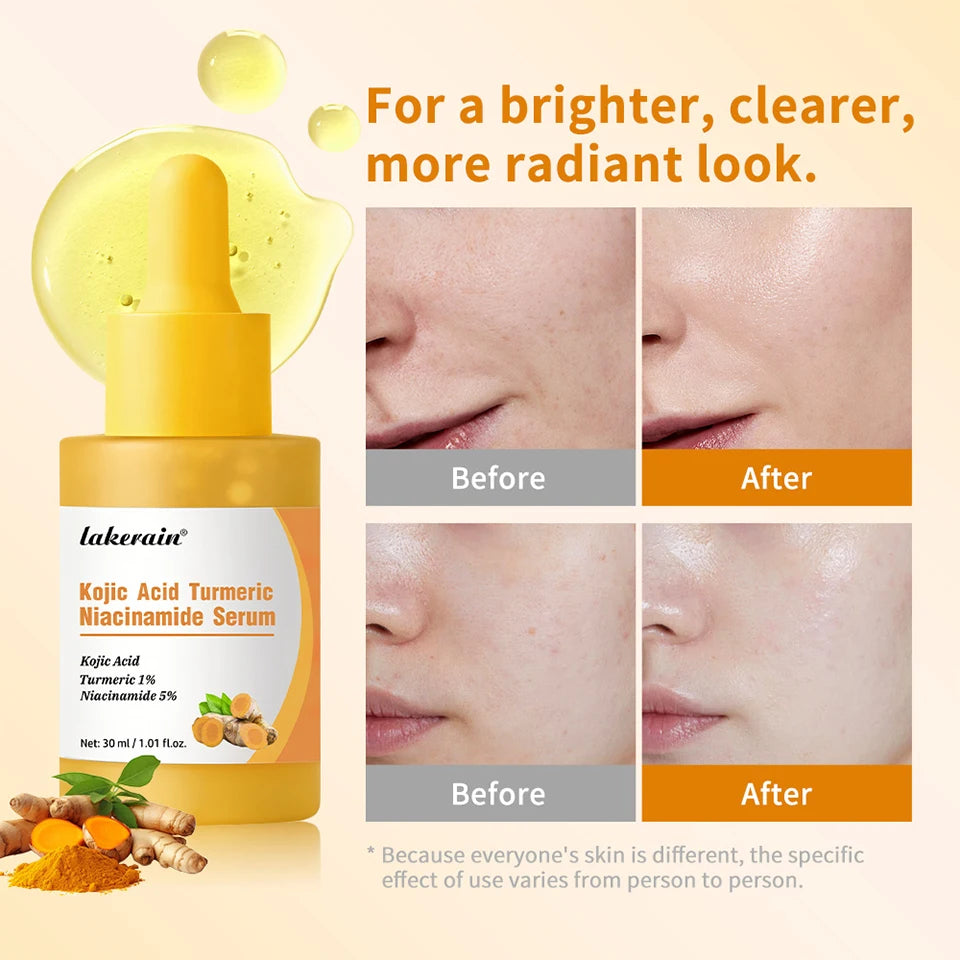 Brightening Kojic Acid and Turmeric Face Serum