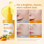 Brightening Kojic Acid and Turmeric Face Serum for Glowing Skin