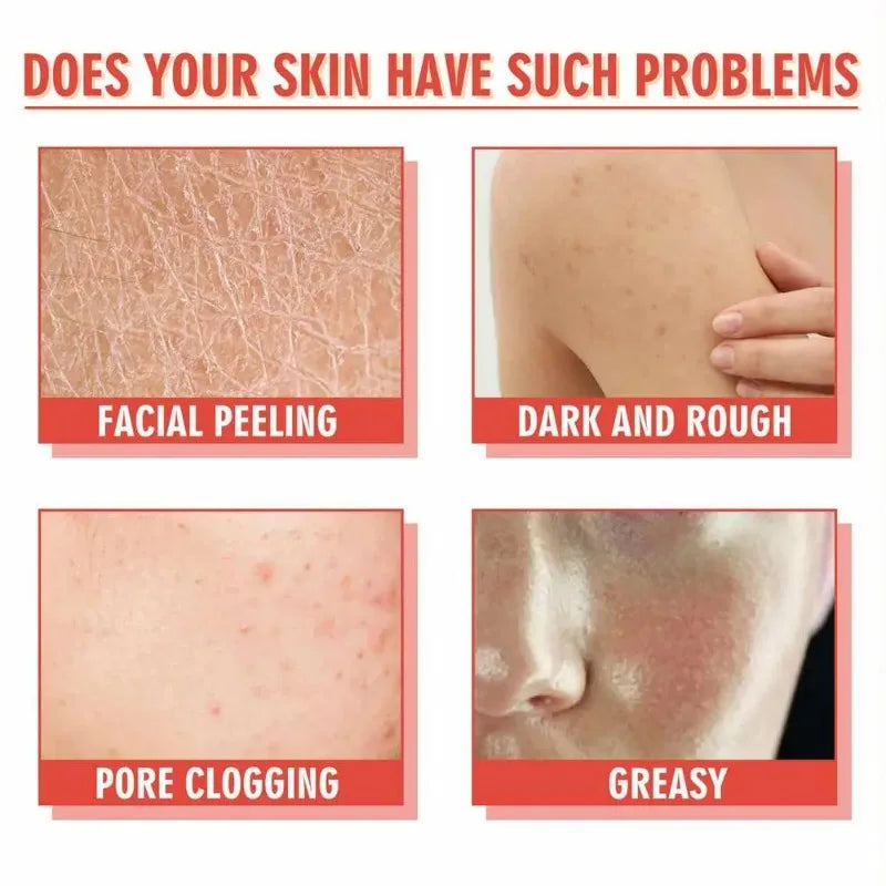 Maigoole Niacinamide Glycerin Face Serum Moisturizing Skin Care Essence - 7