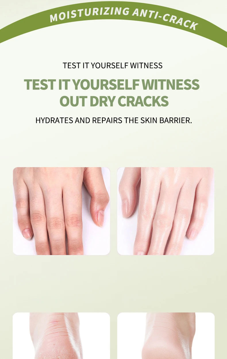 Avocado Moisturizing Balm Stick for Dry Cracked Hands and Feet - 19