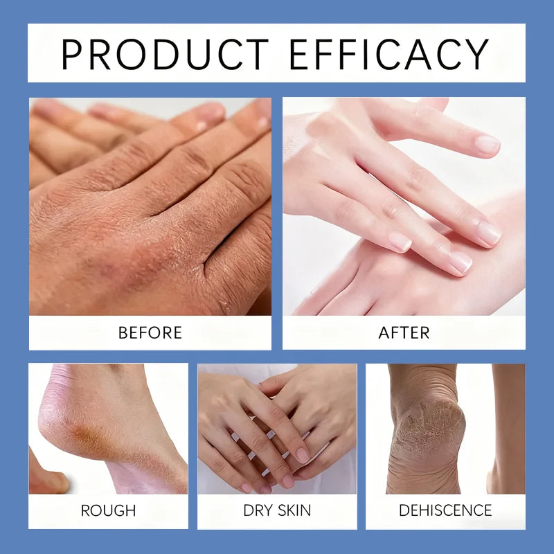 YUITIKUE Magnesium Cream Fast Absorbing Moisturizer for Hands and Feet - 6