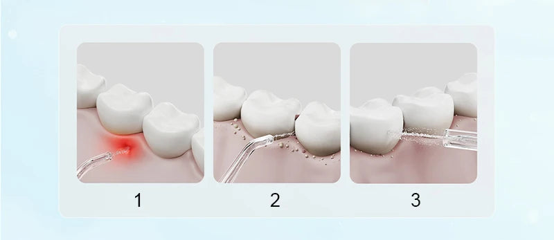 Mijia F300 Electric Oral Irrigator Portable Dental Water Flosser - 8