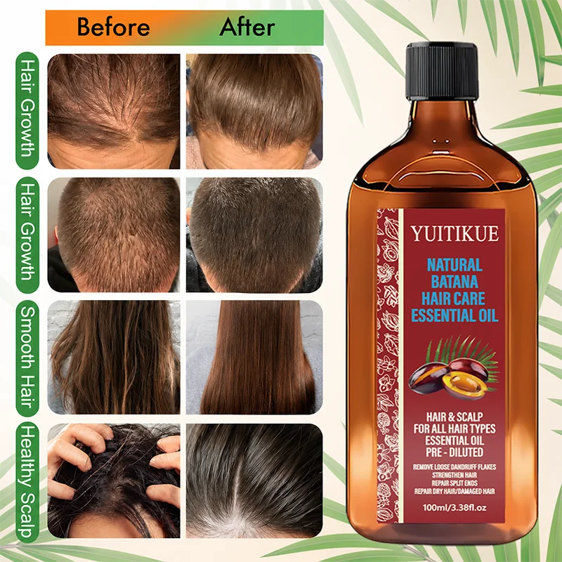 Natural Batana Hair Essential Oil 100ml Cold Pressed Scalp Treatment
