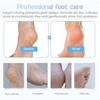 Electric Foot Callus Remover Rechargeable Pedicure File Grinder