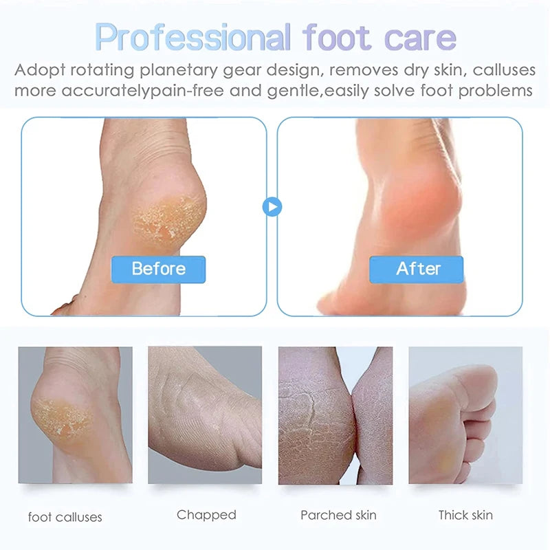 Electric Foot Callus Remover Rechargeable Pedicure File Grinder