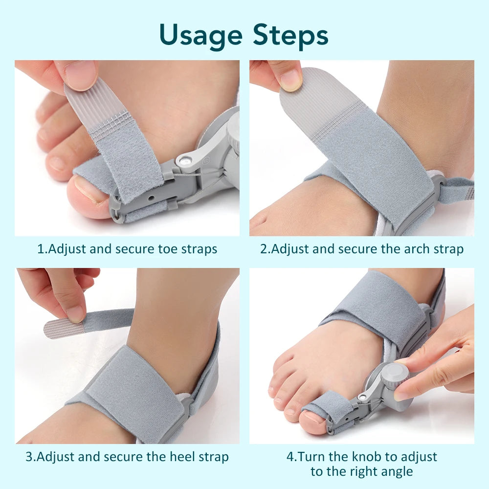 Adjustable Bunion Corrector for Hallux Valgus Pain Relief