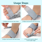 Adjustable Bunion Corrector for Hallux Valgus Pain Relief