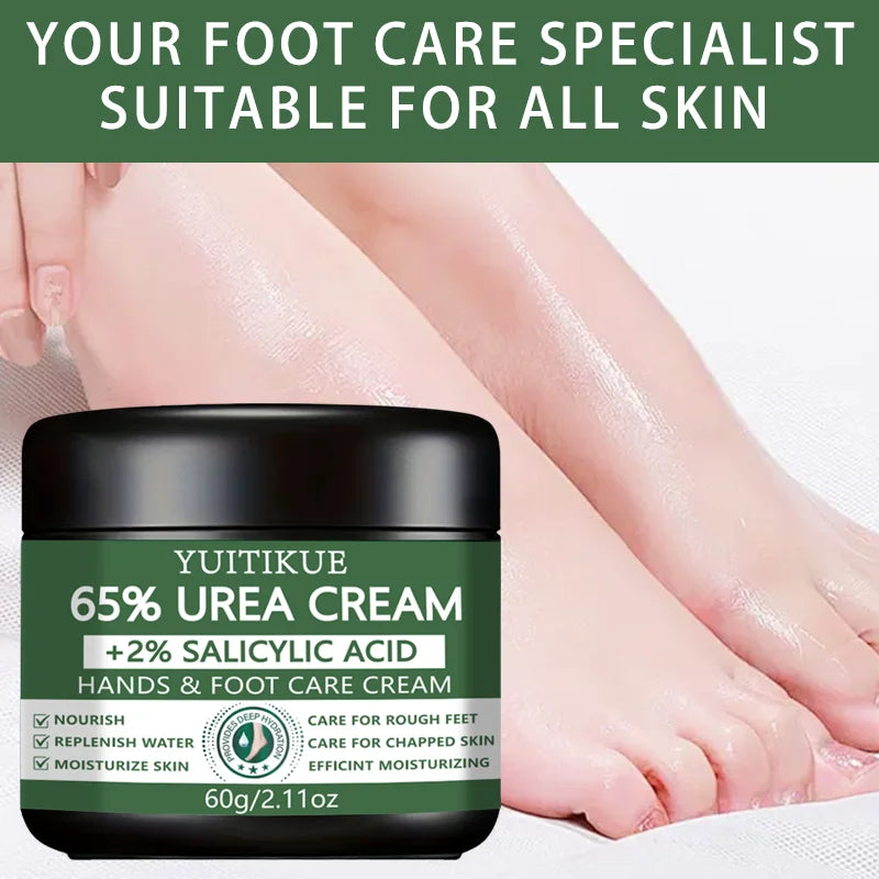 65% Urea Cream with Salicylic Acid for Rough Dry Hands and Feet 60g