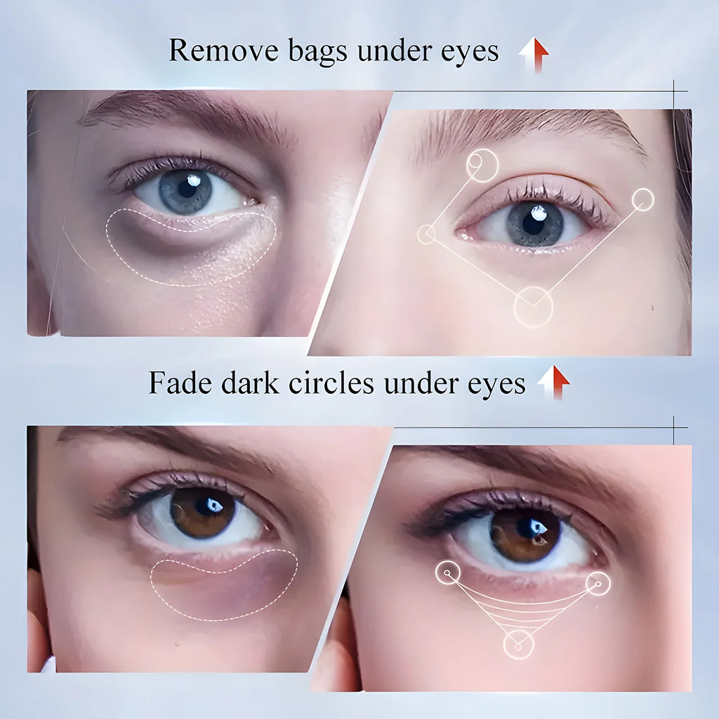 Kojic Acid Eye Cream for Dark Circles and Anti Aging Eye Bags