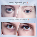 Kojic Acid Eye Cream for Dark Circles and Anti Aging Eye Bags