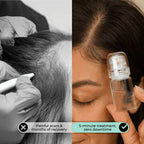 Microneedle Hair Regrowth and Scalp Nourishing Serum Kit