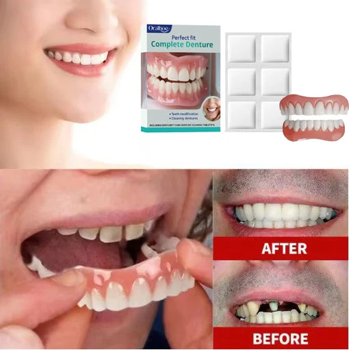 Cosmetic Silicone Dentures for Natural Smile