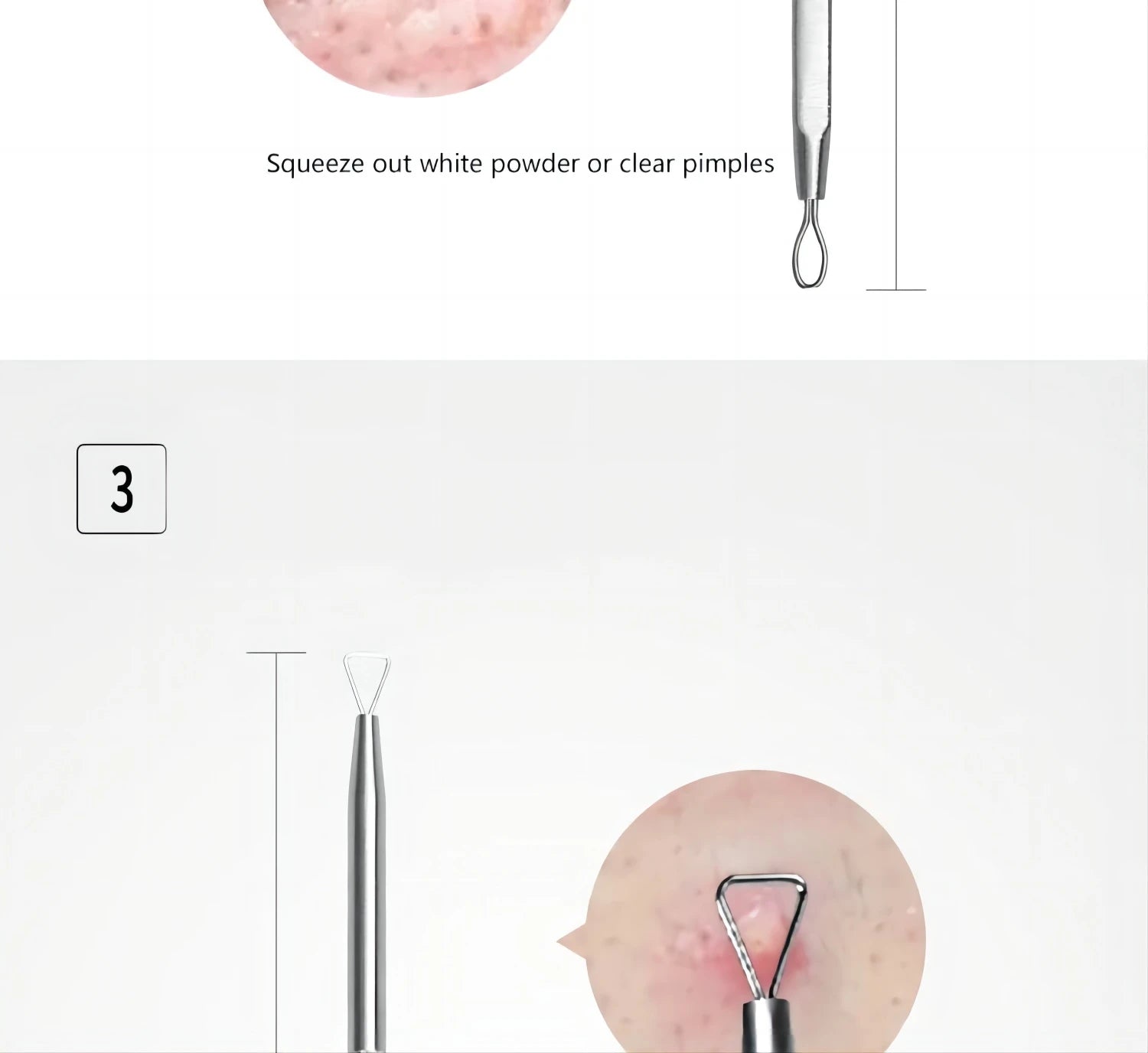 Professional Stainless Steel Blackhead and Pimple Extractor Tool Kit - 14