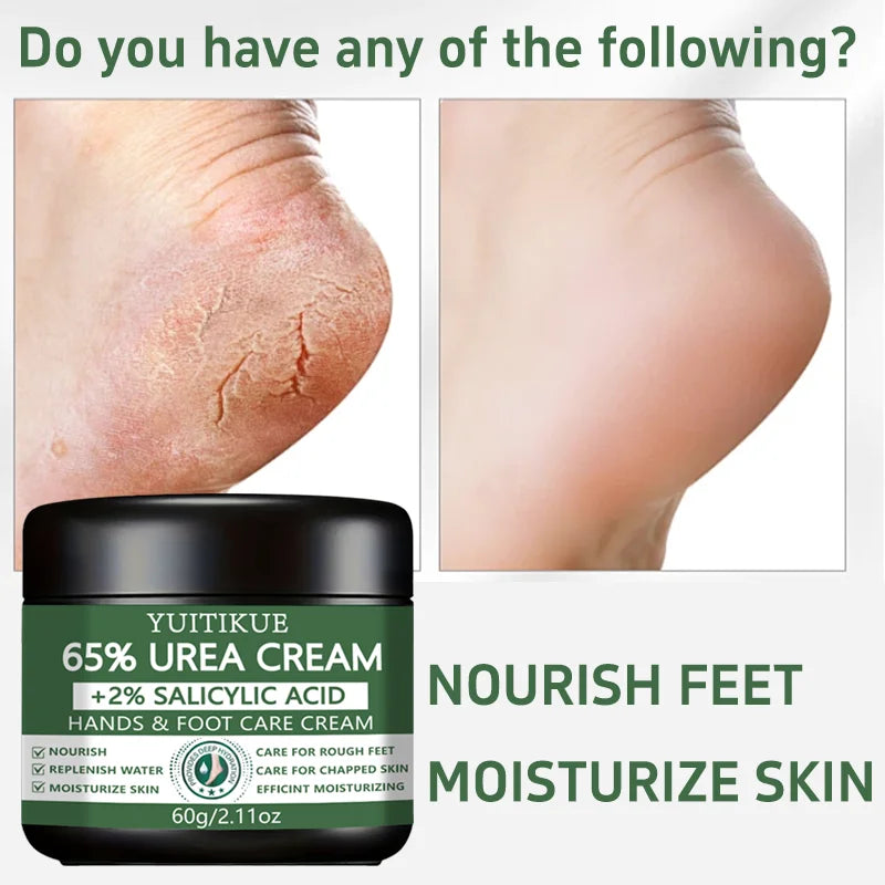 65% Urea Cream with Salicylic Acid for Rough Dry Hands and Feet 60g - 6