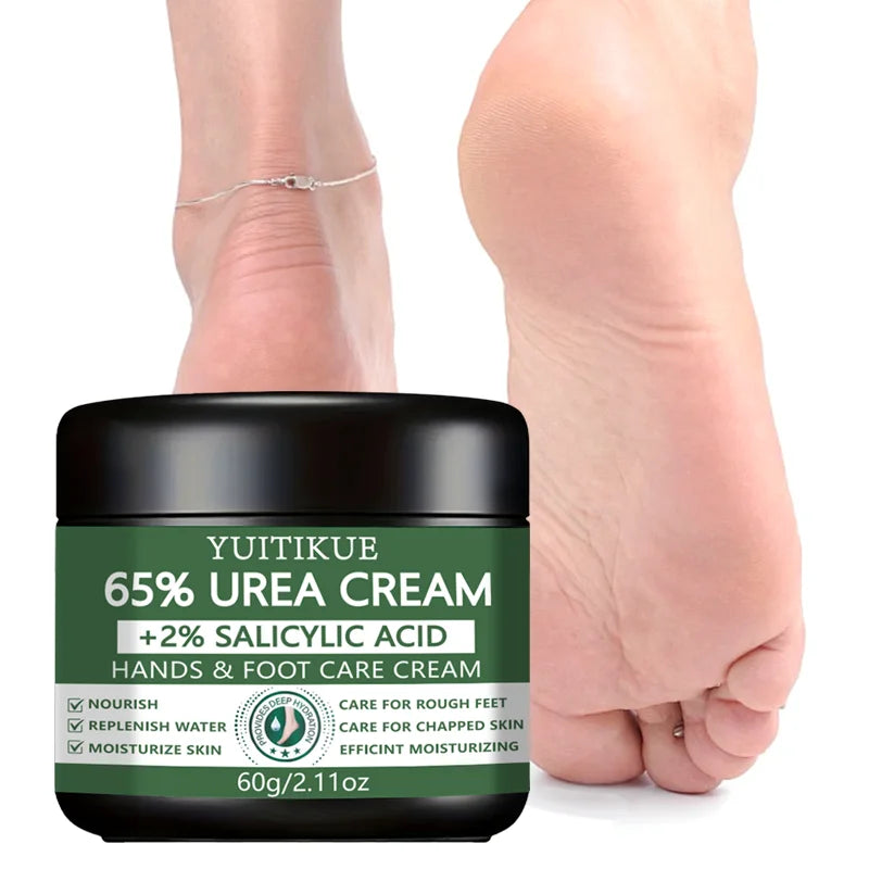 65% Urea Cream with Salicylic Acid for Rough Dry Hands and Feet 60g - 1