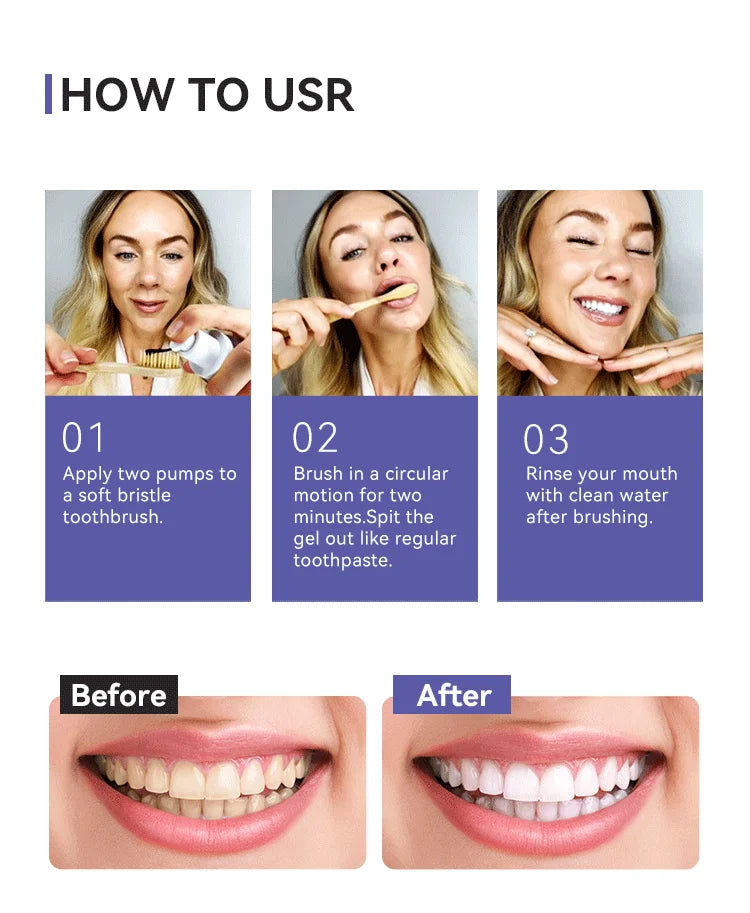Portable Rechargeable Oral Irrigator and Teeth Whitening Kit