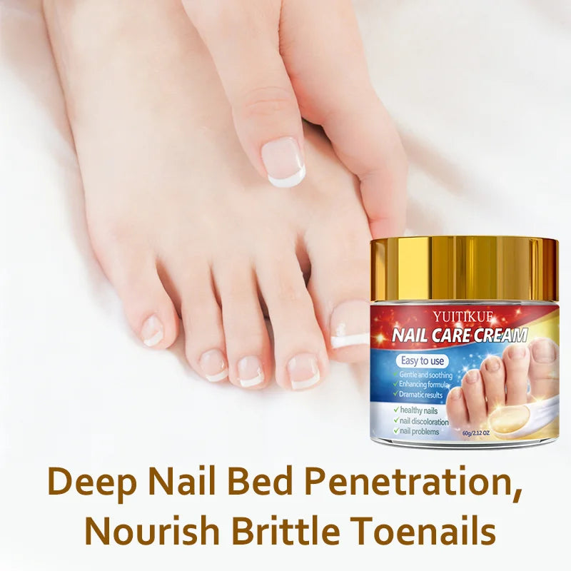 Yuitikue Nail Repair Cream 60g for Discolored and Damaged Nails