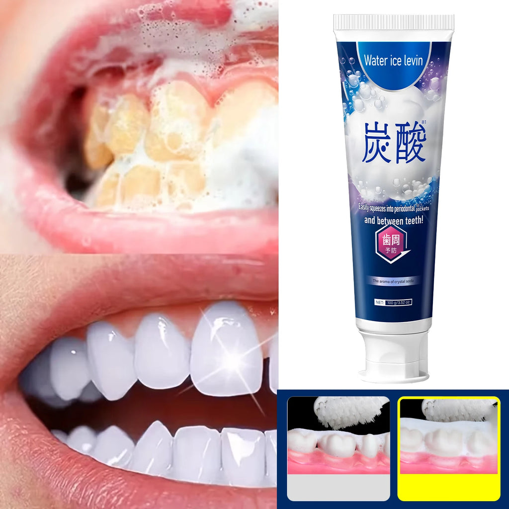 Hydroxyapatite Toothpaste Remineralizing Gum Repair Mint Flavor 100g