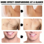 Water Ice Levin Painless Hair Removal Cream for Men and Women 150g
