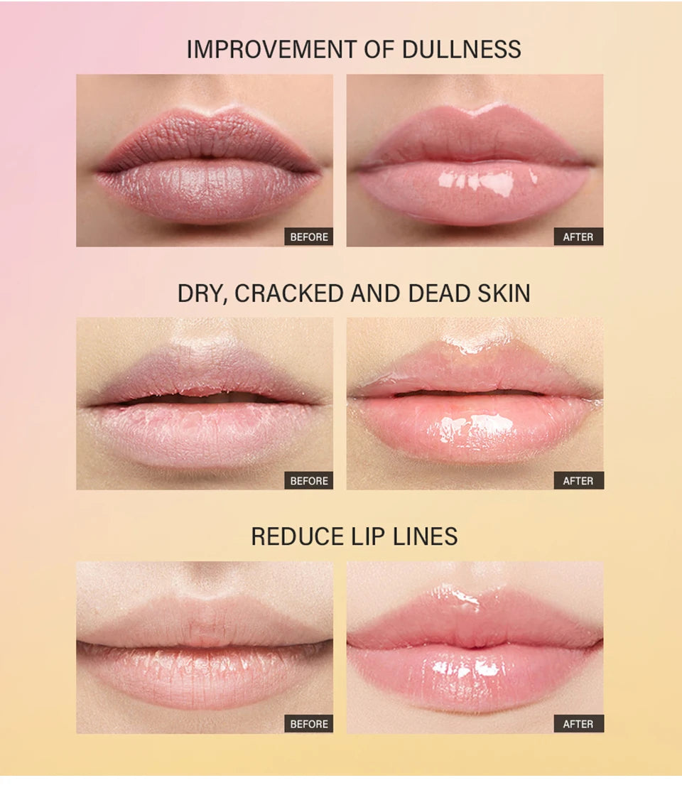 Peptide Moisturizing Lip Treatment for Dry Chapped Lips