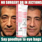 Retinol Anti-Aging Eye Cream for Dark Circles and Puffiness