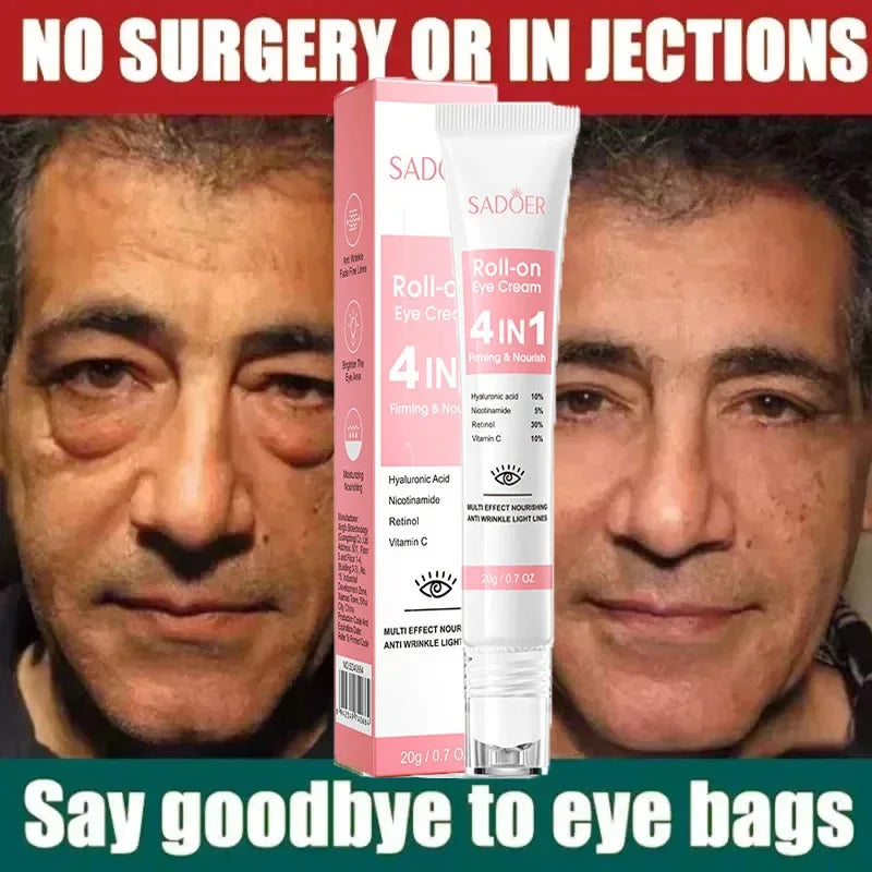 Retinol Anti-Aging Eye Cream for Dark Circles and Puffiness