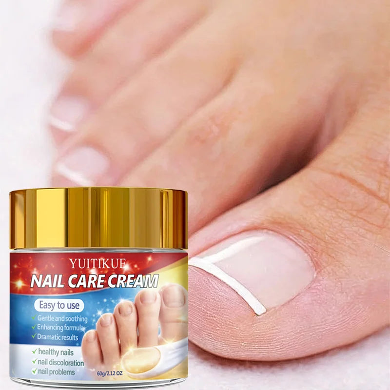Yuitikue Nail Repair Cream 60g for Discolored and Damaged Nails - 3