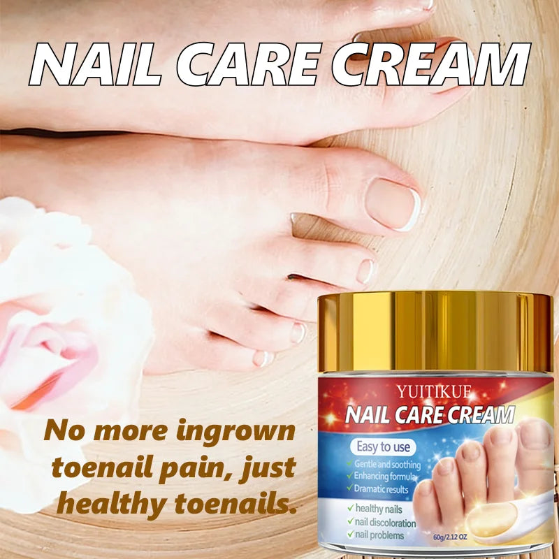 Yuitikue Nail Repair Cream 60g for Discolored and Damaged Nails - 5