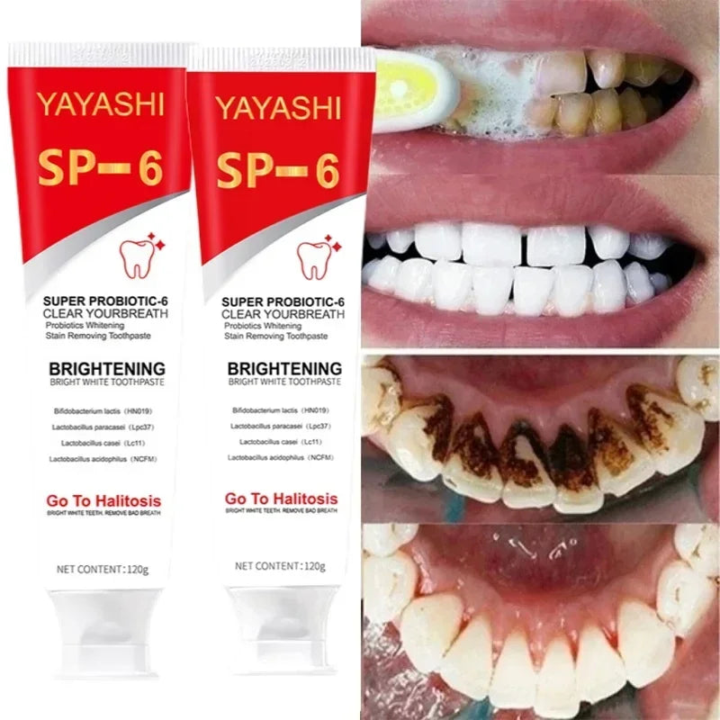 Probiotic Teeth Whitening Toothpaste for Stain Removal