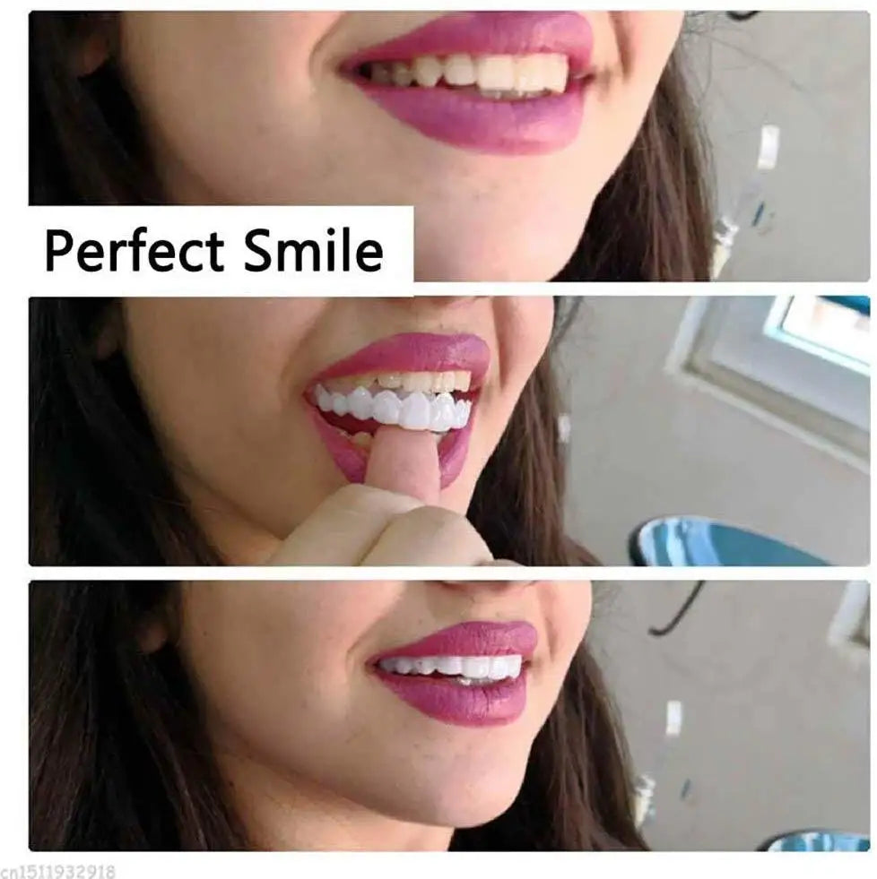 Snap On Smile Veneers Cosmetic Teeth Whitening Denture Set
