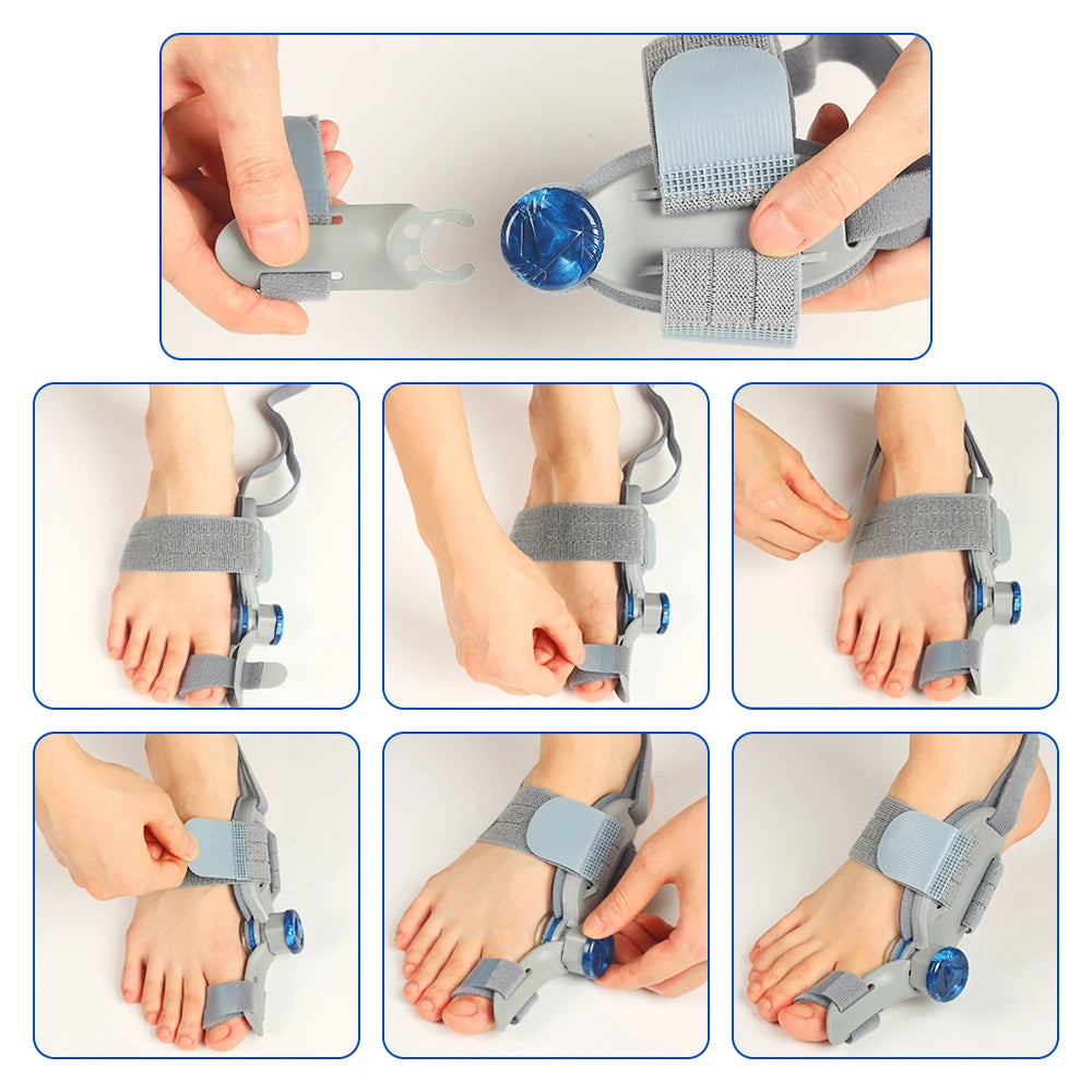 Adjustable Bunion Corrector and Toe Straightener Brace
