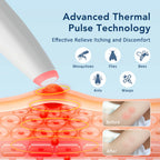 Portable Electronic Insect Bite Itch Relief Pen