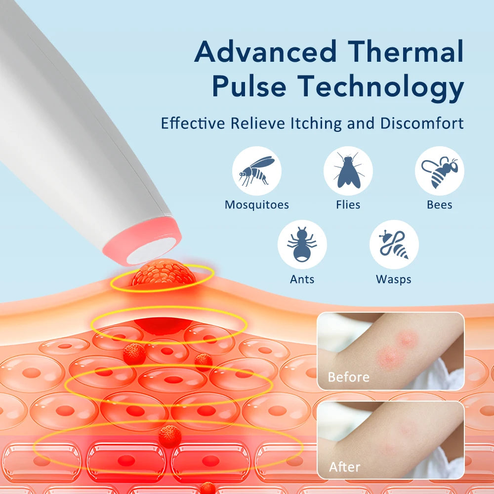 Portable Electronic Insect Bite Itch Relief Pen