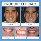 Adjustable Snap-On Smile Veneers for Missing Teeth