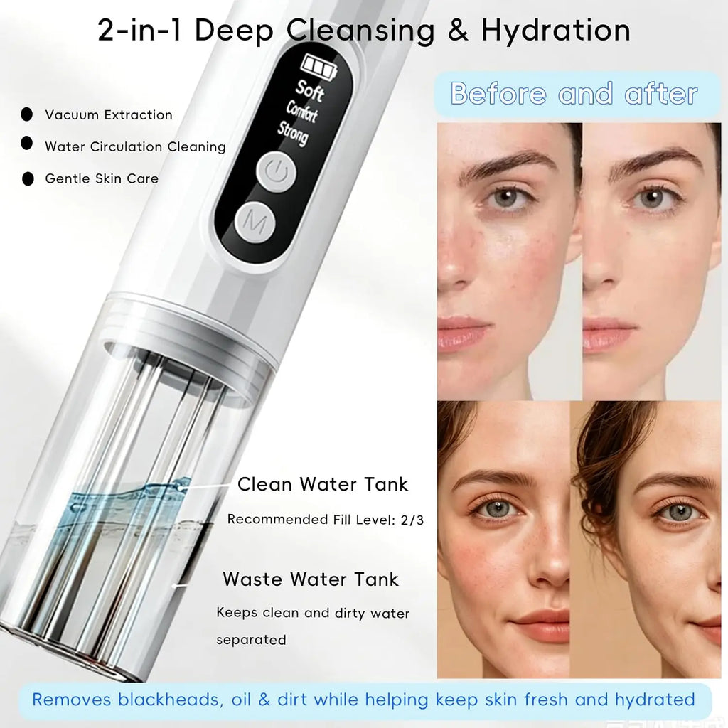 Electric Hydrating Pore Vacuum Blackhead Remover