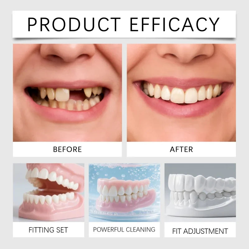 Temporary Silicone Denture Set for Missing or Broken Teeth