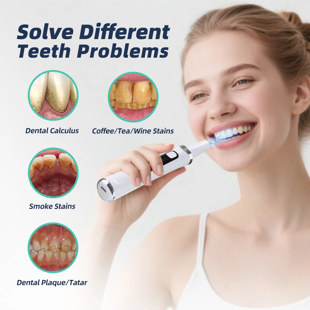 Ultrasonic Electric Teeth Tartar and Plaque Remover - 15