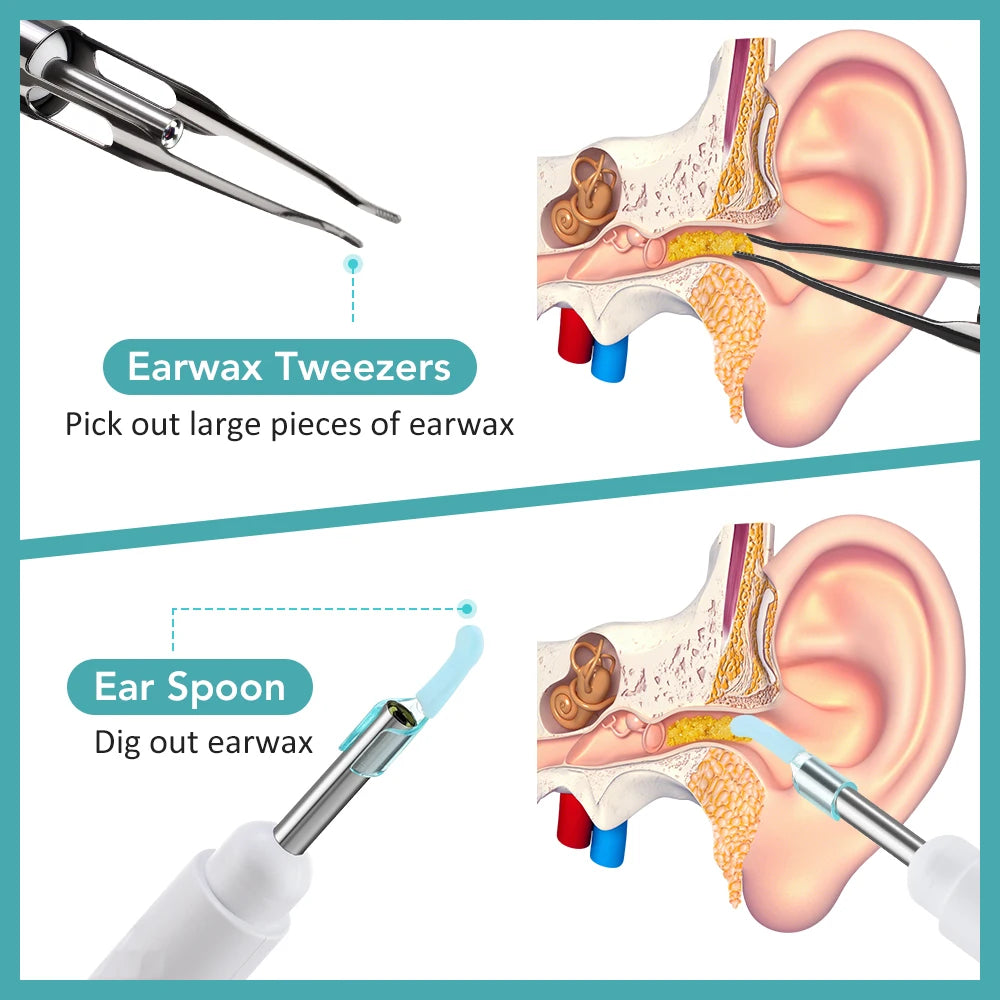 Smart Visual Ear Wax Removal Tool with HD Camera - 9