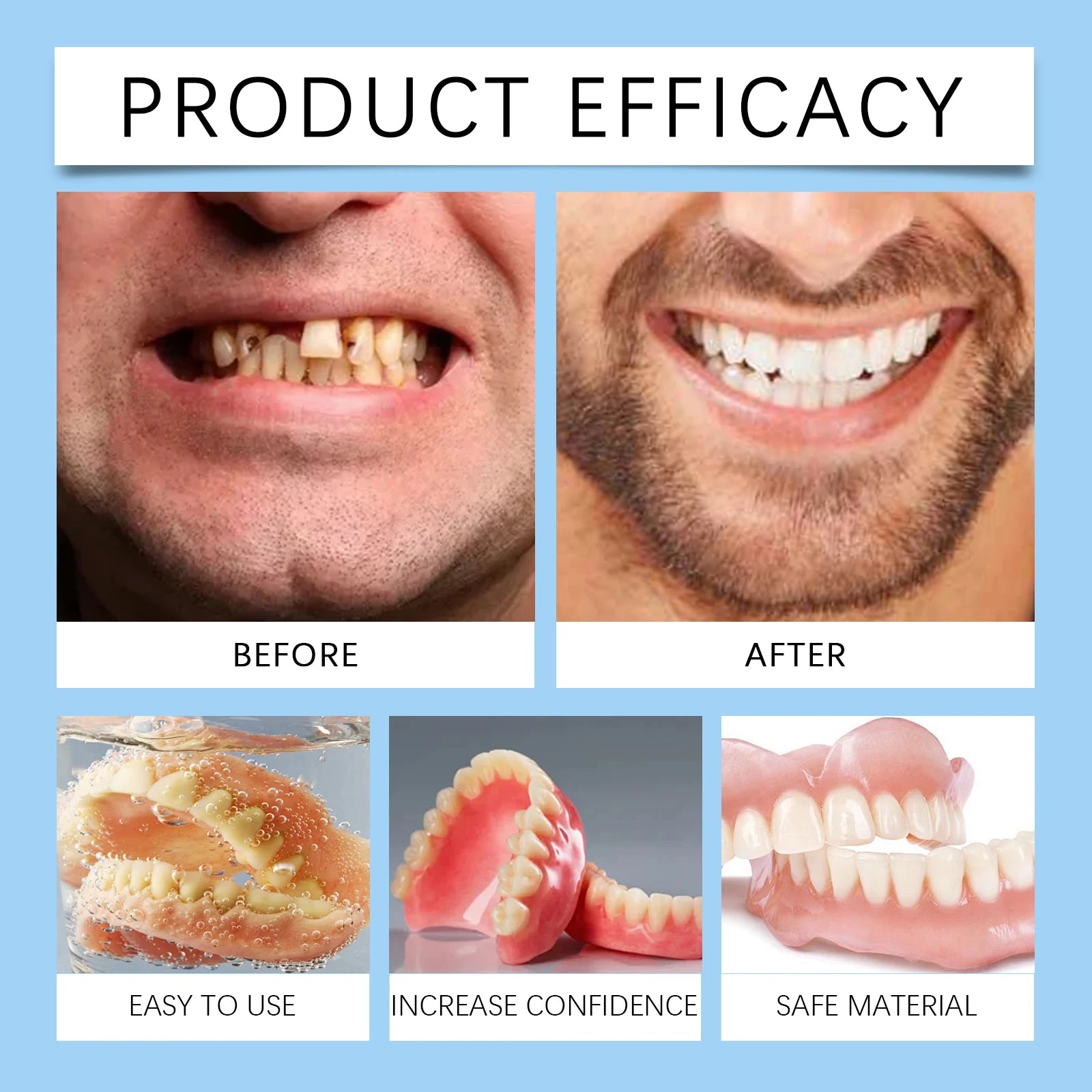 Temporary Silicone Snap-On Dentures for Instant Smile Whitening - 3